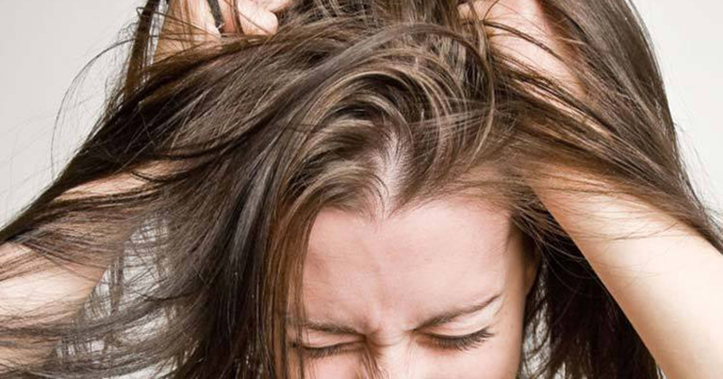 What should I do if I have dandruff and itchy scalp